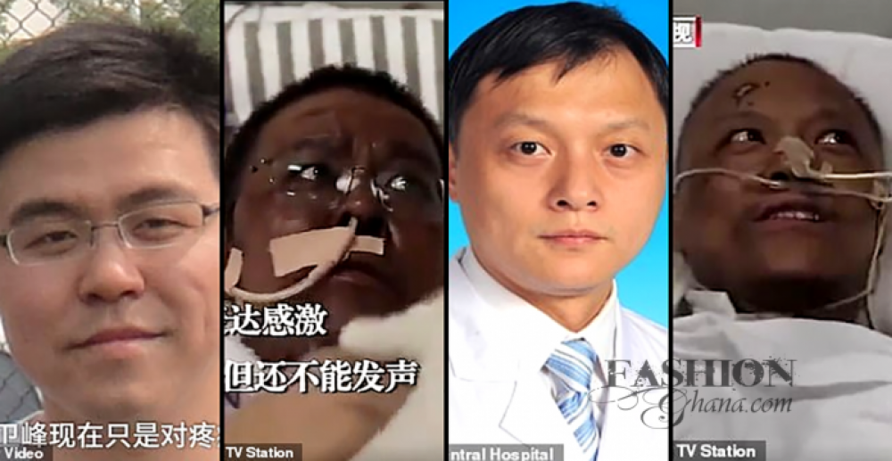 أعراض غريبة لمصابين بفيروس كورونا في الصين