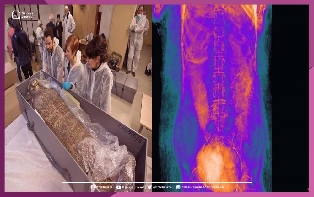 الكشف عن أول مومياء مصرية حامل 