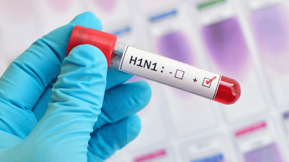 انفلونزا الخنازير يجتاح الأردن وحالات وفاة 