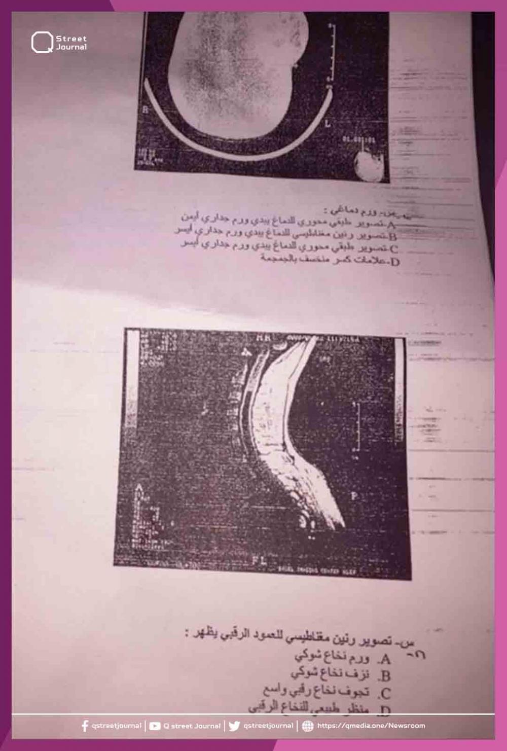جامعة دمشق تطبع أوراق امتحانية لطلاب الطب يصعب رؤيتها.. والعميد تساهلنا مع الطلاب؟ 