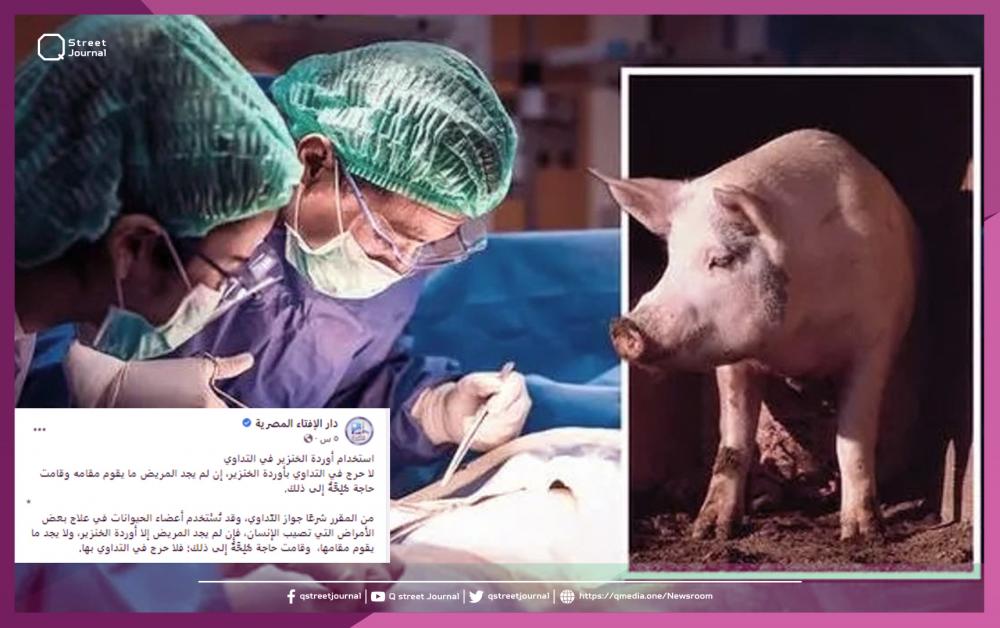 الإفتاء المصرية تعلّق على مسألة التداوي بأوردة الخنزير