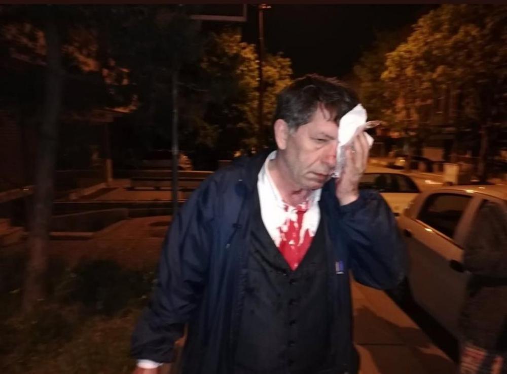انتقد أردوغان.. فتم ضربه
